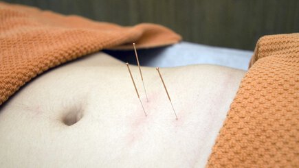 Acupuncture clinics in SingaporeCustomer reviews